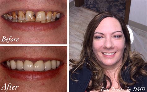 Cosmetic Dental Surgery .